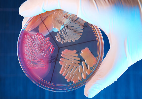 Pathological bacteria Food Borne Illness