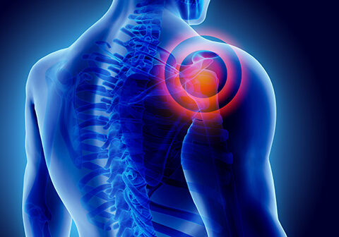 Reverse Shoulder Implant Injuries